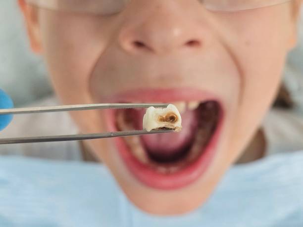 Best Emergency Treatment for Oral Infections in Cordova, NC
