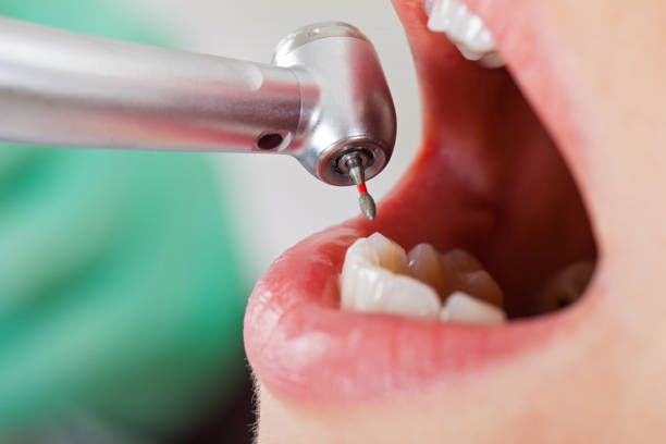 Best Broken or Chipped Tooth Repair in Cordova, NC